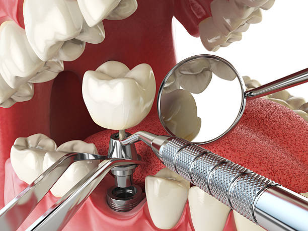 Best Emergency Cosmetic Dentistry (e.g., broken veneers) in Kendall Park, NJ